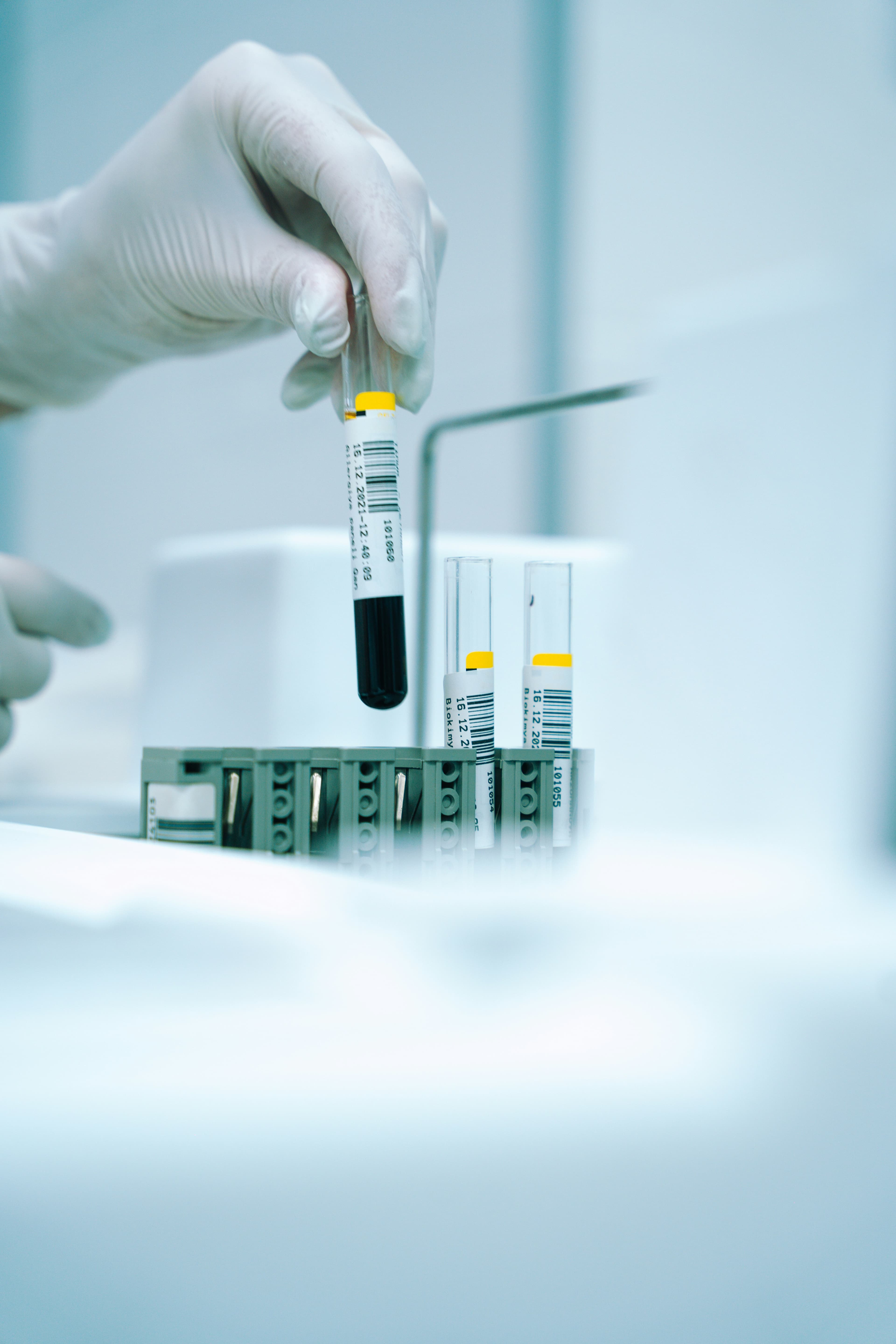 Gloved hand holding a blood sample vial in a clinical laboratory