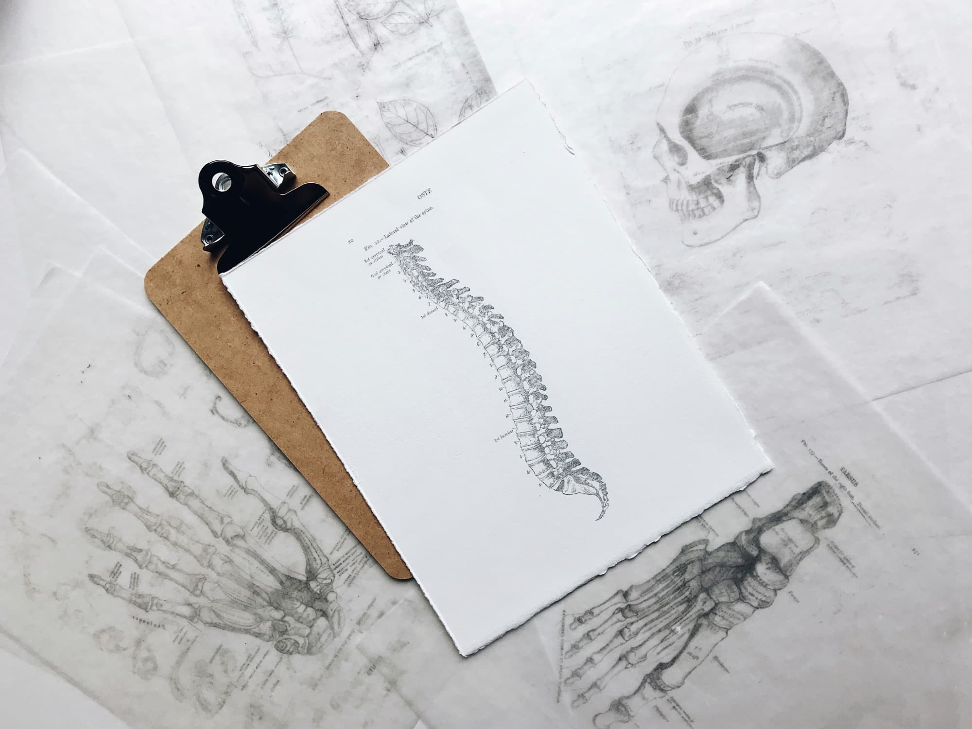 Anatomical spine illustrations on a clipboard