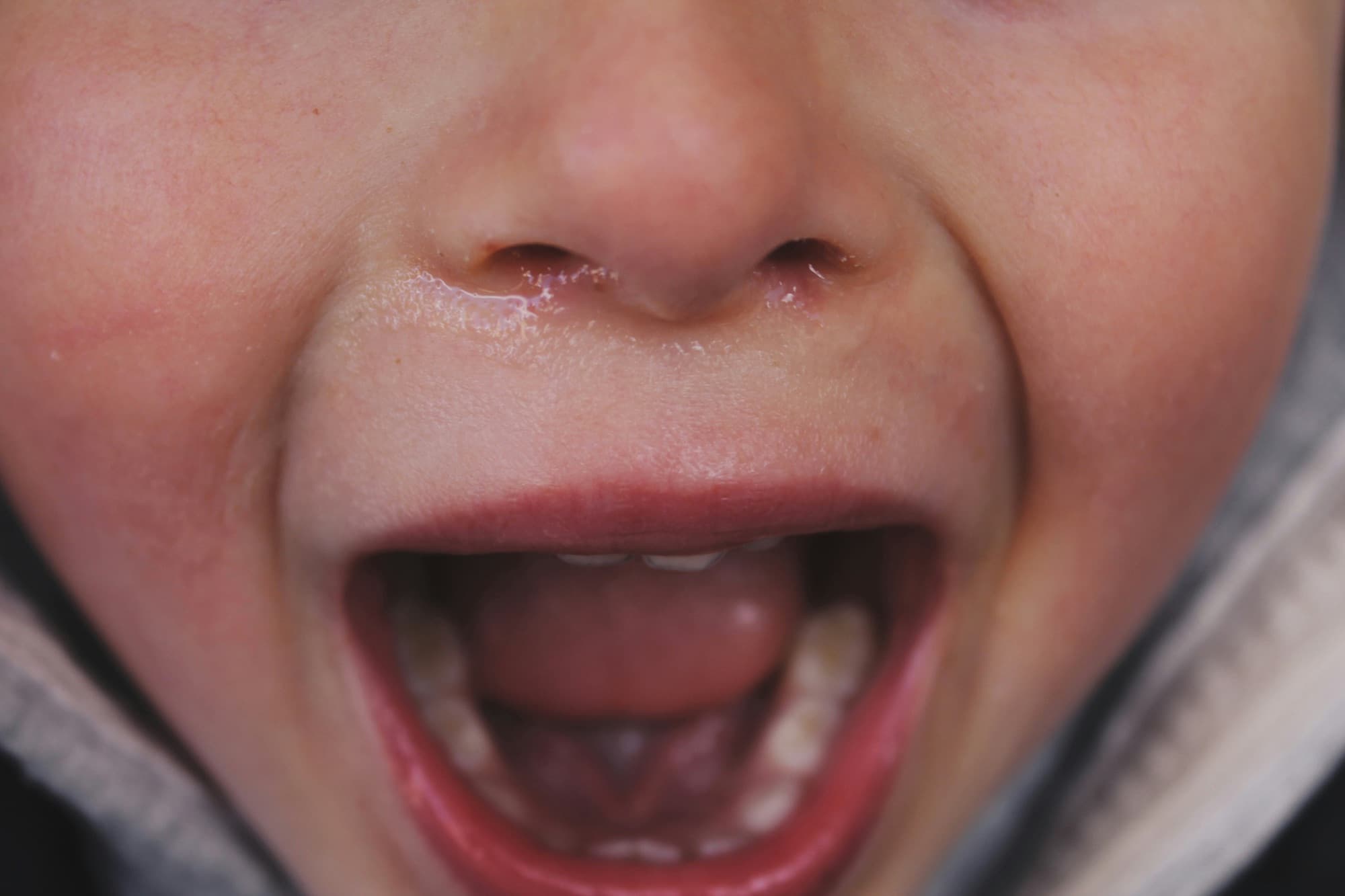 Close-up of a toddler's open mouth showing first teeth